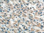 Alpha Tubulin Antibody in Immunohistochemistry (Paraffin) (IHC (P))