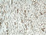 Alpha Tubulin Antibody in Immunohistochemistry (Paraffin) (IHC (P))