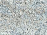 Cytokeratin 7 Antibody in Immunohistochemistry (Paraffin) (IHC (P))