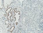 Cytokeratin 7 Antibody in Immunohistochemistry (Paraffin) (IHC (P))