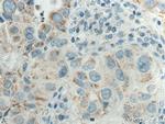 Cytokeratin 7 Antibody in Immunohistochemistry (Paraffin) (IHC (P))