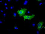 BIRC5/Survivin Antibody in Immunocytochemistry (ICC/IF)