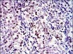 Survivin Antibody in Immunohistochemistry (Paraffin) (IHC (P))