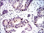 Survivin Antibody in Immunohistochemistry (Paraffin) (IHC (P))