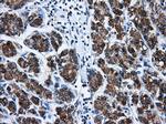 BIRC7 Antibody in Immunohistochemistry (Paraffin) (IHC (P))