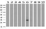 BIRC7 Antibody in Western Blot (WB)