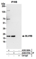 BLVRB/Biliverdin reductase B Antibody in Western Blot (WB)