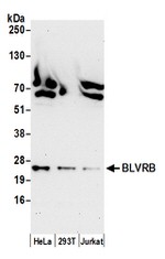 BLVRB/Biliverdin reductase B Antibody in Western Blot (WB)