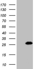 BMF Antibody in Western Blot (WB)