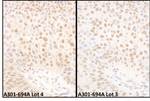 BMI1 Antibody in Immunohistochemistry (IHC)