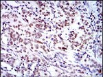 BMI-1 Antibody in Immunohistochemistry (Paraffin) (IHC (P))