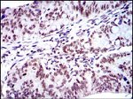 BMI-1 Antibody in Immunohistochemistry (Paraffin) (IHC (P))