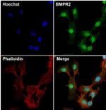BMPR2 Antibody in Immunocytochemistry (ICC/IF)
