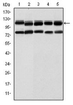 BMPR2 Antibody in Western Blot (WB)