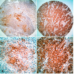 CD44var (v3-v10) Antibody in Immunohistochemistry (IHC)