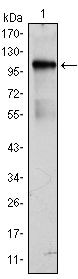 ETK Antibody in Western Blot (WB)