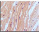 BNP Antibody in Immunohistochemistry (Paraffin) (IHC (P))