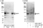 BOP1 Antibody in Western Blot (WB)