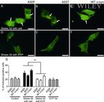 alpha Synuclein Antibody in Immunocytochemistry (ICC/IF)