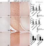 alpha Synuclein Antibody in Immunohistochemistry (IHC)