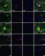 alpha Synuclein Antibody in Immunocytochemistry (ICC/IF)