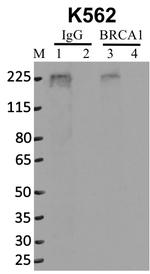 BRCA1 Antibody in RNA Immunoprecipitation (RIP)