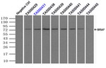 BRAF Antibody in Immunoprecipitation (IP)