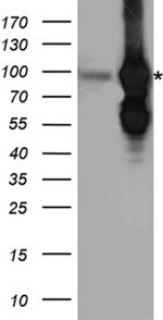 BRAF Antibody in Western Blot (WB)