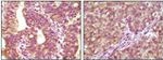 B-Raf Antibody in Immunohistochemistry (Paraffin) (IHC (P))