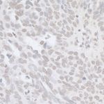 BRCA1 Antibody in Immunohistochemistry (IHC)