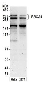 BRCA1 Antibody in Western Blot (WB)