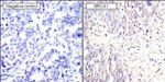 BRCA1 Antibody in Immunohistochemistry (Paraffin) (IHC (P))