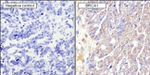 BRCA1 Antibody in Immunohistochemistry (Paraffin) (IHC (P))