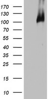 BRCA1 Antibody in Western Blot (WB)