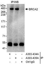 BRCA2 Antibody in Immunoprecipitation (IP)