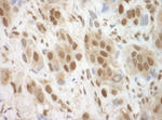 BRCC36 Antibody in Immunohistochemistry (IHC)