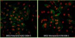 BRD2 Antibody in Immunocytochemistry (ICC/IF)