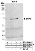 BRD2 Antibody in Western Blot (WB)