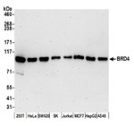 BRD2 Antibody in Western Blot (WB)