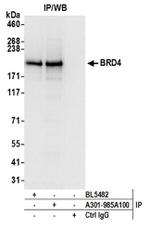 BRD4 Antibody in Western Blot (WB)