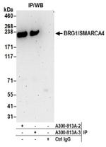 BRG1/SMARCA4 Antibody in Western Blot (WB)