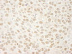 BRG1/SMARCA4 Antibody in Immunohistochemistry (IHC)