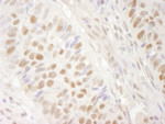 BRG1/SMARCA4 Antibody in Immunohistochemistry (IHC)