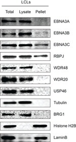 BRG1 Antibody in Western Blot (WB)