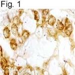 Bombesin Receptor 3 Antibody in Immunohistochemistry (Paraffin) (IHC (P))