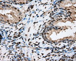 BSG Antibody in Immunohistochemistry (Paraffin) (IHC (P))