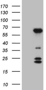 BTBD10 Antibody in Western Blot (WB)