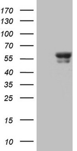 BTBD3 Antibody in Western Blot (WB)