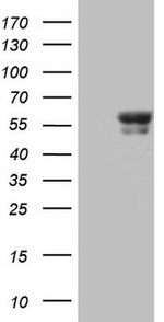 BTBD3 Antibody in Western Blot (WB)