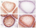 Procollagen IIA N-Peptide Antibody in Immunohistochemistry (Paraffin) (IHC (P))